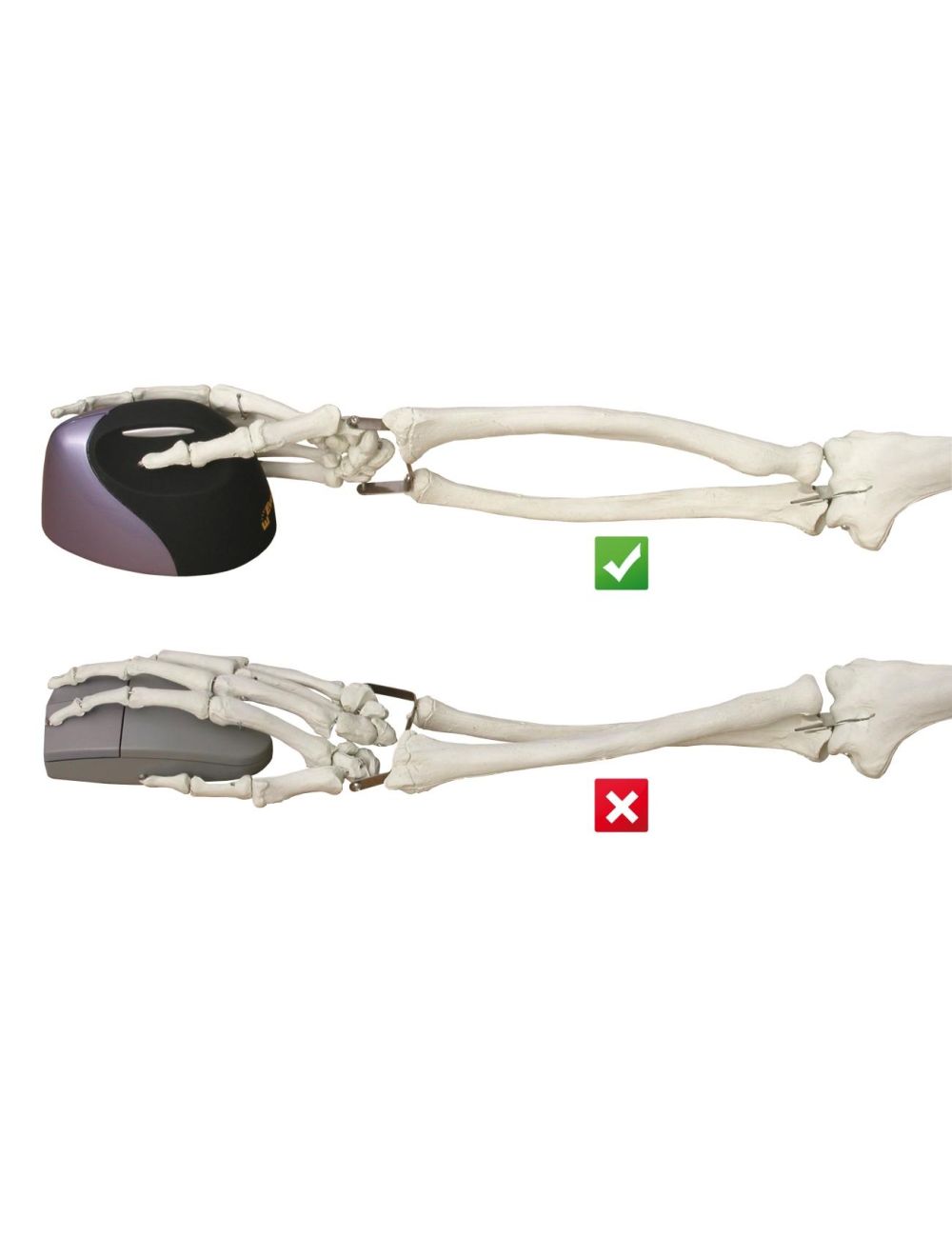 Evoluent VerticalMouse 4 Rechts Draadloze