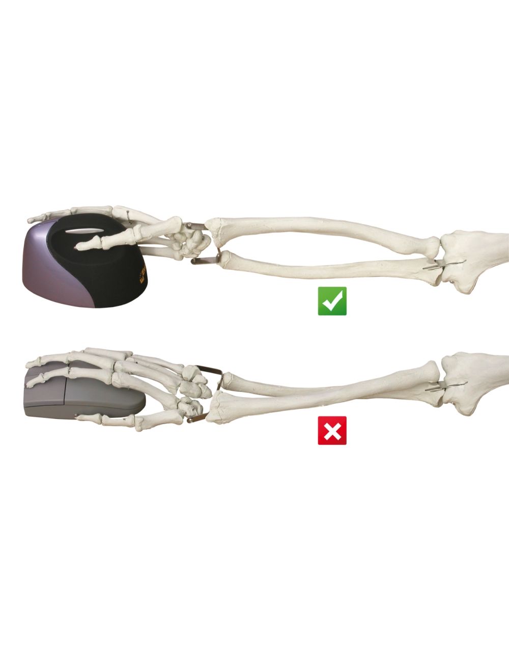 Evoluent VerticalMouse 4 Links